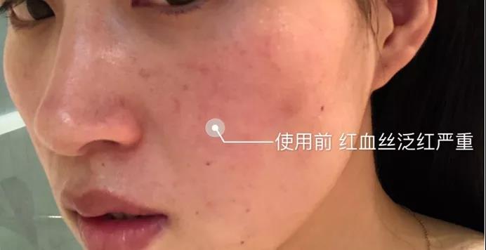 包邊燒烤網(wǎng)250x250mm方形